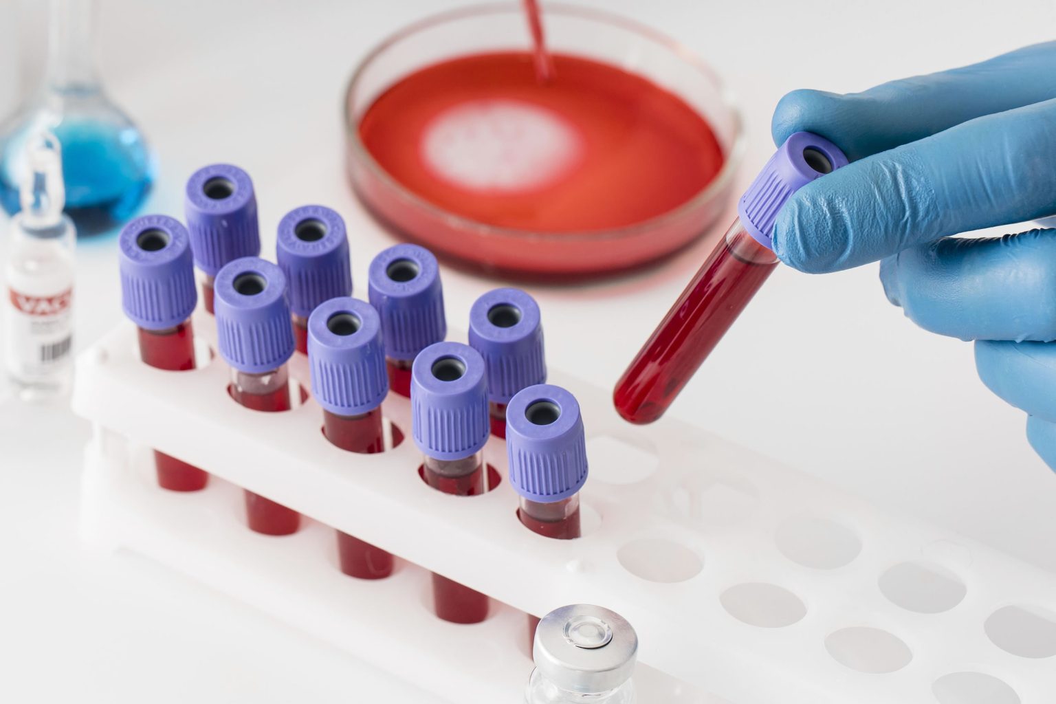 Clinical Trials Monitoring and Site Management